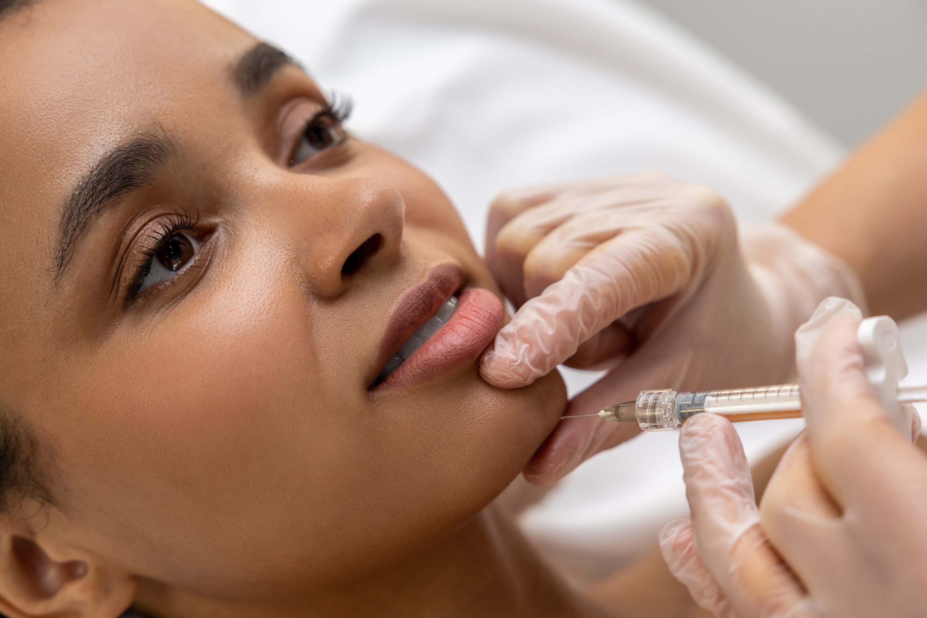 Lip care. Dark-skinned woman having hyaluronic acid injection into lips